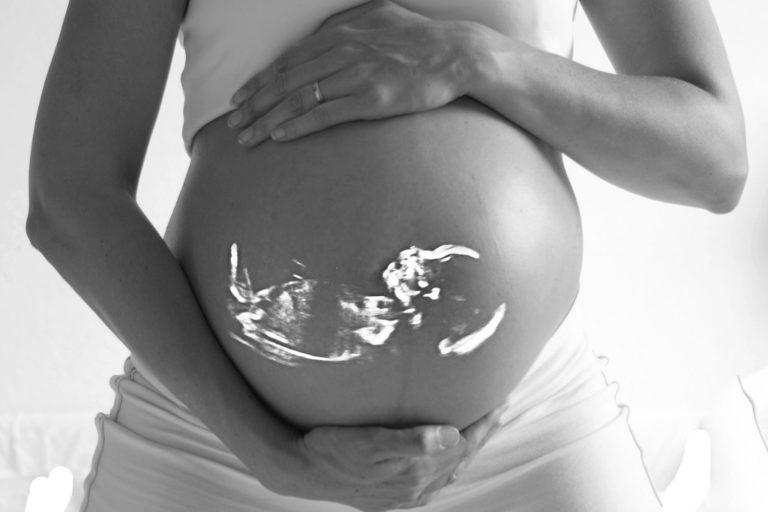 pregnancy week-by-week - bump ultrasound