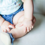 eczema - toddler