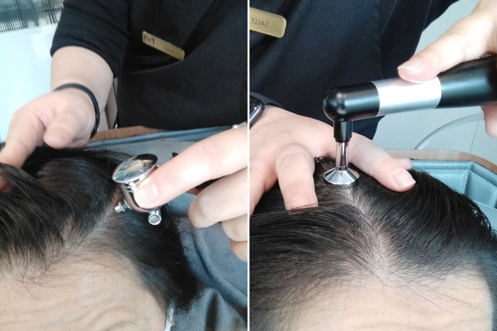 MSCS procedure by PHS HAIRSCIENCE