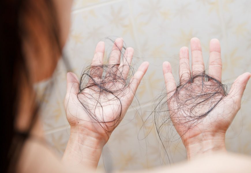 hair loss on hands