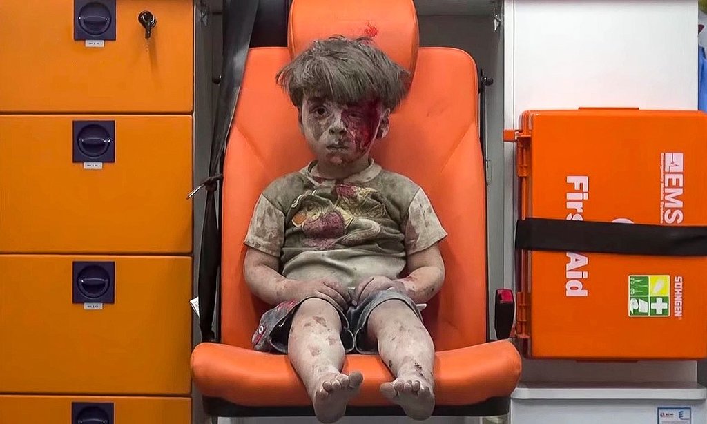 Aleppo bombings shellshocked boy Image: NBC News