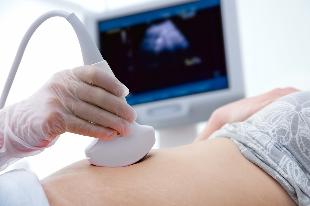 MediSave for pregnancy - scan