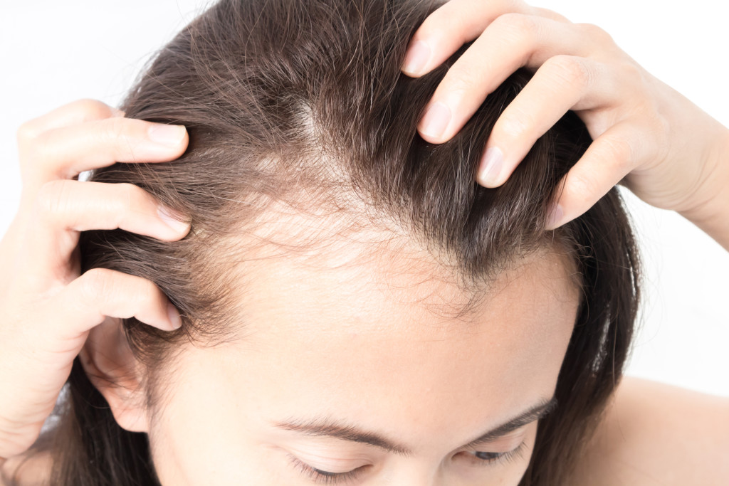 common causes of hair loss - overzealous hairstyling