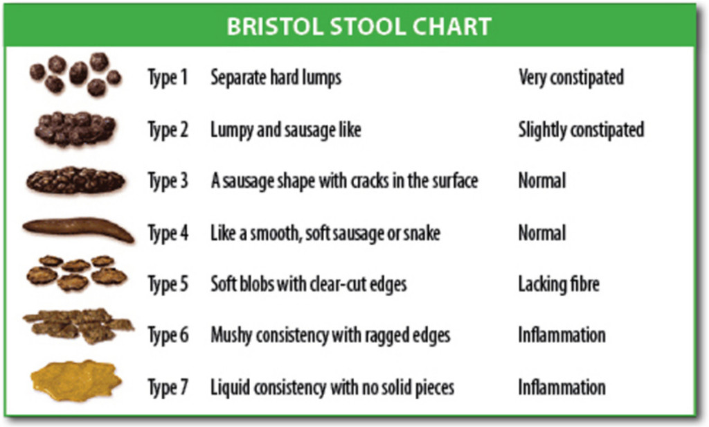 Bristol Stool Chart indicates constipation