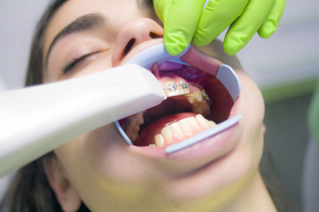 orthodontic treatment - conventional metal braces
