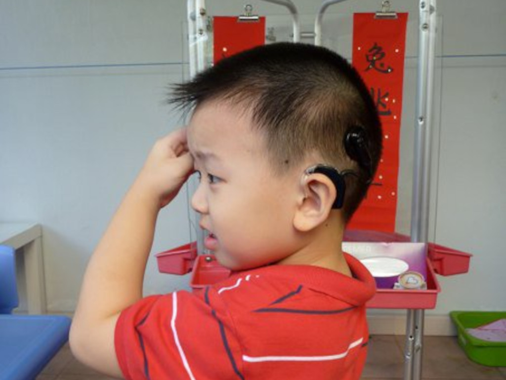 born deaf, Hon Wei with cochlear implant in preschool