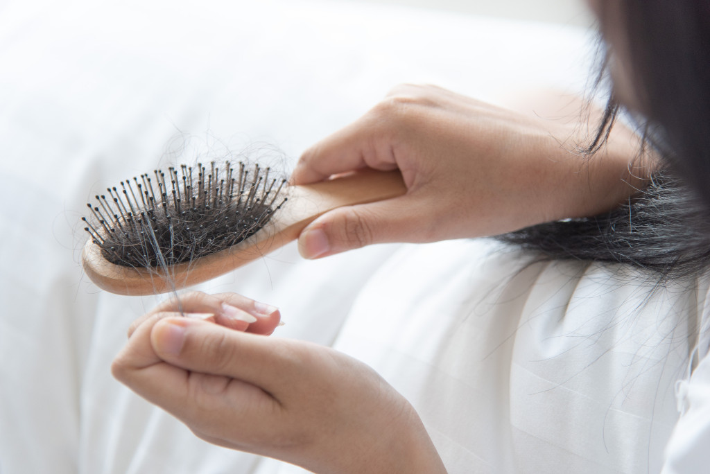 postpartum hairloss